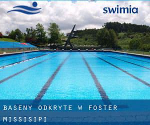 Baseny Odkryte w Foster (Missisipi)